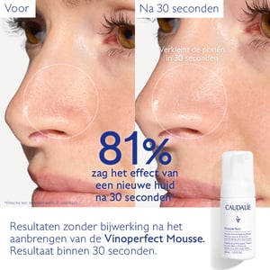 Caudalie Vinoperfect Micro-Peeling Mousse Stralende Huid Caudalie Vinoperfect Micro-Peeling Mousse Stralende Huid afbeelding
