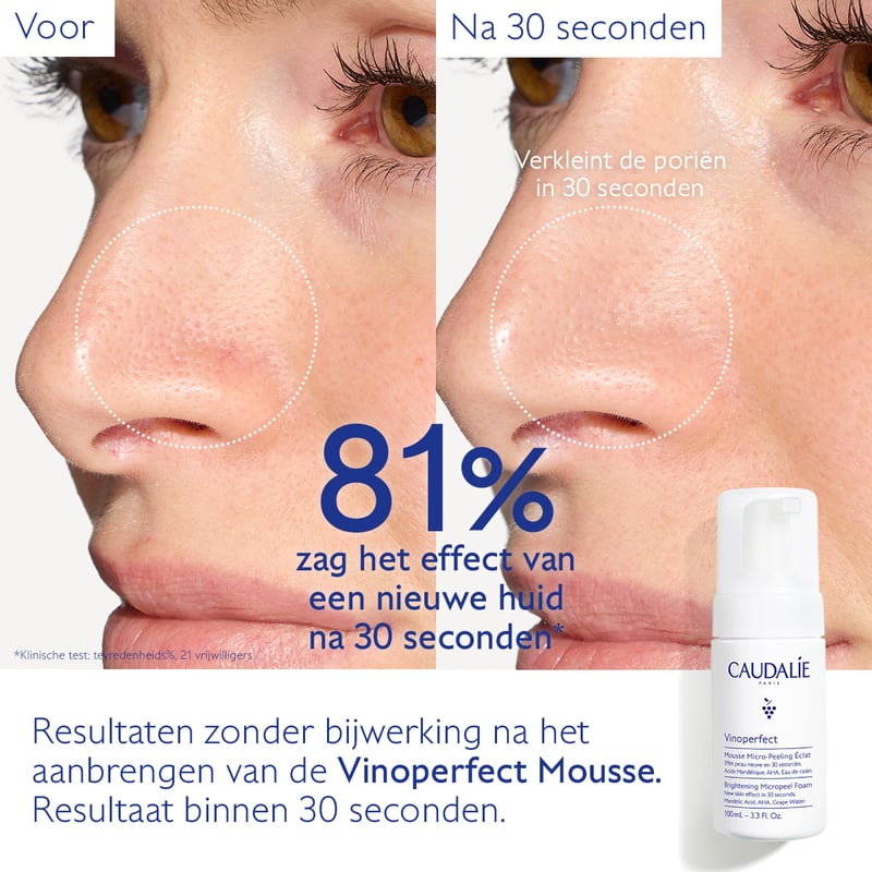 Caudalie Vinoperfect Micro-Peeling Mousse Stralende Huid Caudalie Vinoperfect Micro-Peeling Mousse Stralende Huid afbeelding