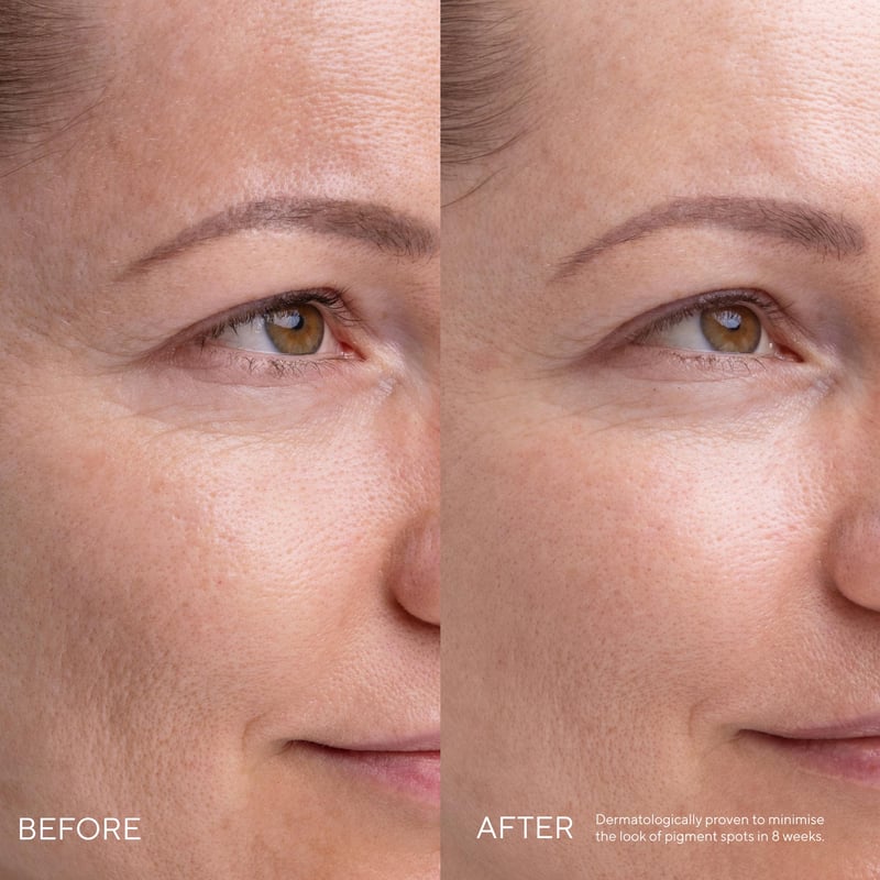 MADARA Kojic Alternative Pigment Serum MADARA Kojic Alternative Pigment Serum afbeelding